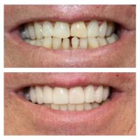 NÜVA Smile ico