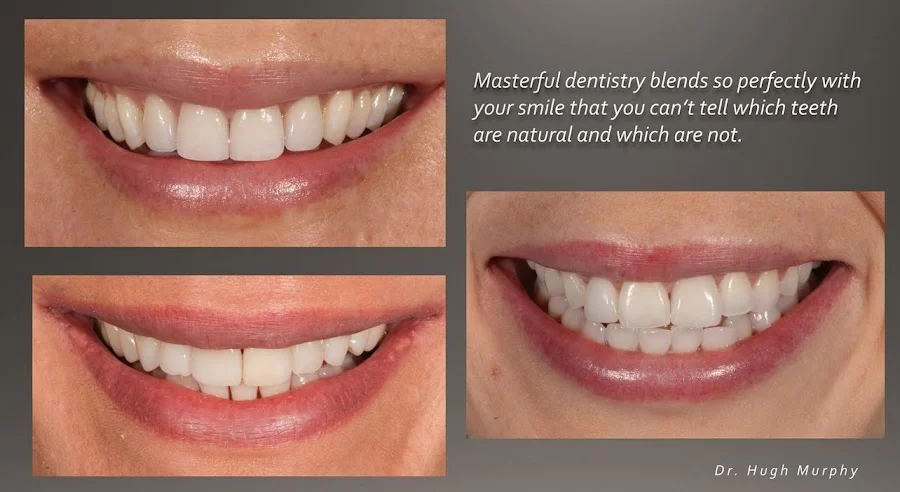 Premier Prosthodontics: Advanced Aesthetic and Implant Dentistry 2