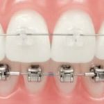 Henn Orthodontics