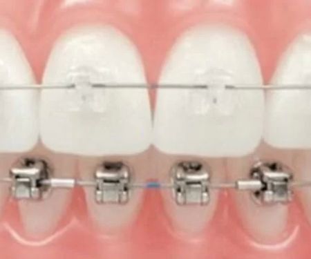Henn Orthodontics