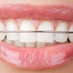 Ernstberger Orthodontics