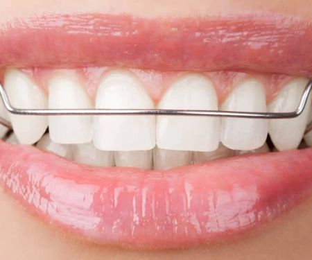 Ernstberger Orthodontics