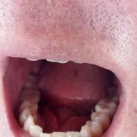 Dental Care at Dr. Phillips ico