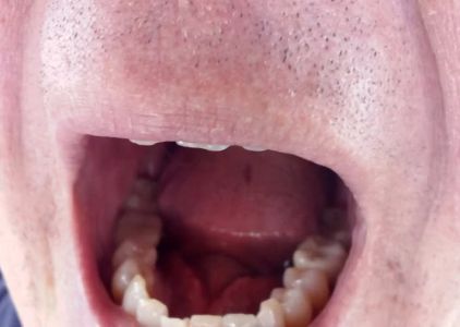 Dental Care at Dr. Phillips