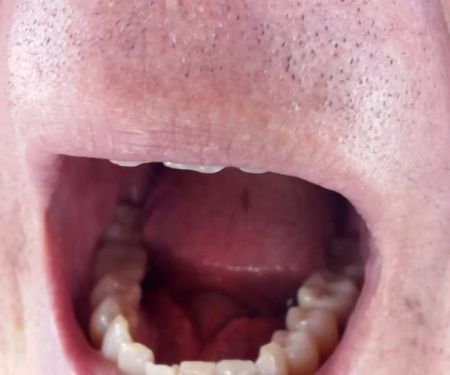 Dental Care at Dr. Phillips