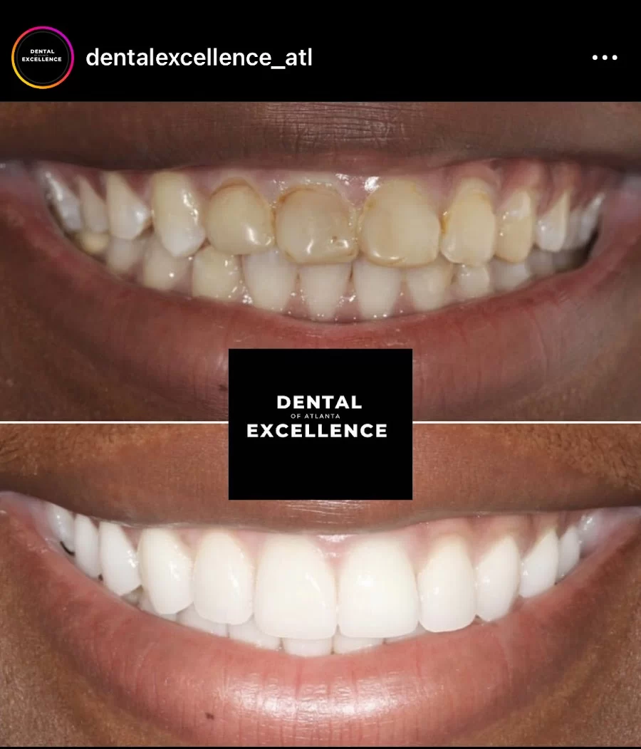 Dental Excellence of Atlanta 3