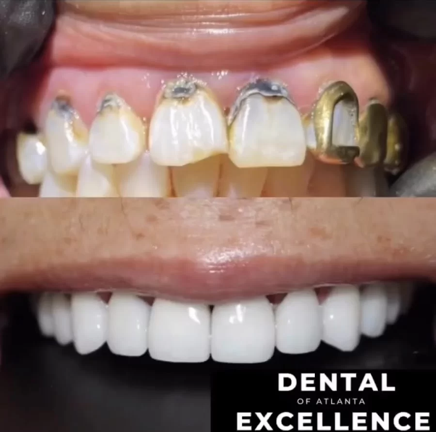 Dental Excellence of Atlanta 2