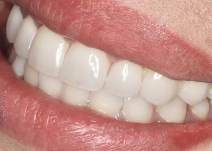 Imperial Smile Dentistry