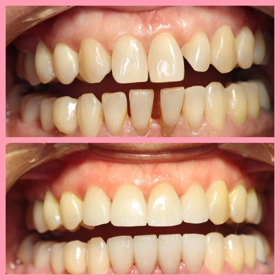 Blessed Smile Dentistry of Yorba Linda 2