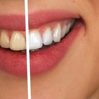 El Camino Dental ico