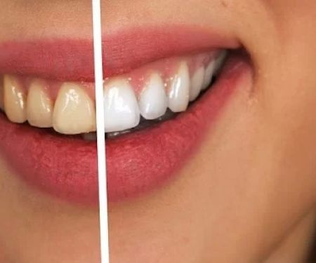 El Camino Dental