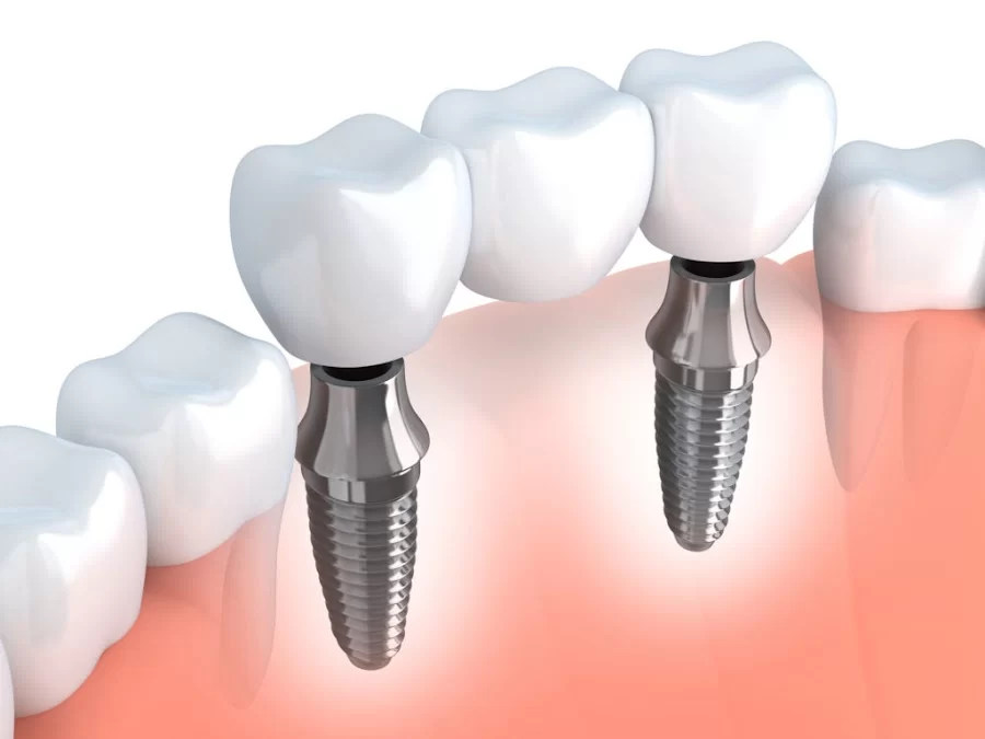 Bismarck Advanced Dental and Implants 1