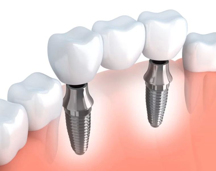 Bismarck Advanced Dental and Implants