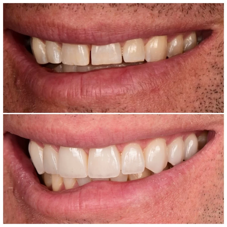 Asaro Dental Aesthetics 6