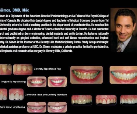 Periodontal and Implant Specialists of Beverly Hills