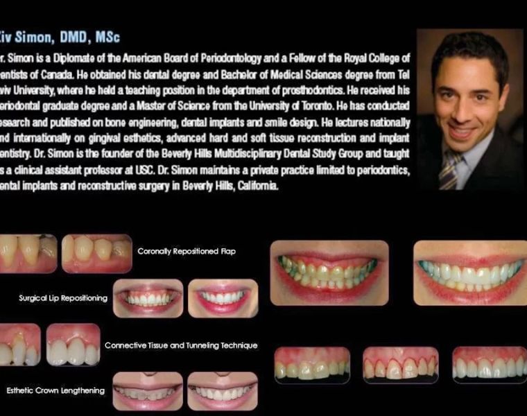 Periodontal and Implant Specialists of Beverly Hills