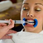 Crystal White Smile