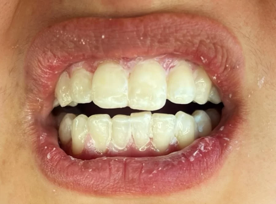 Marina Smiles Dentistry Picture 4