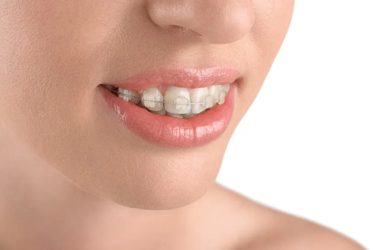 Pita Orthodontics Picture 3