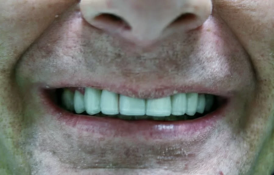 Diamond Dental Group Of Diamond Bar Picture 2