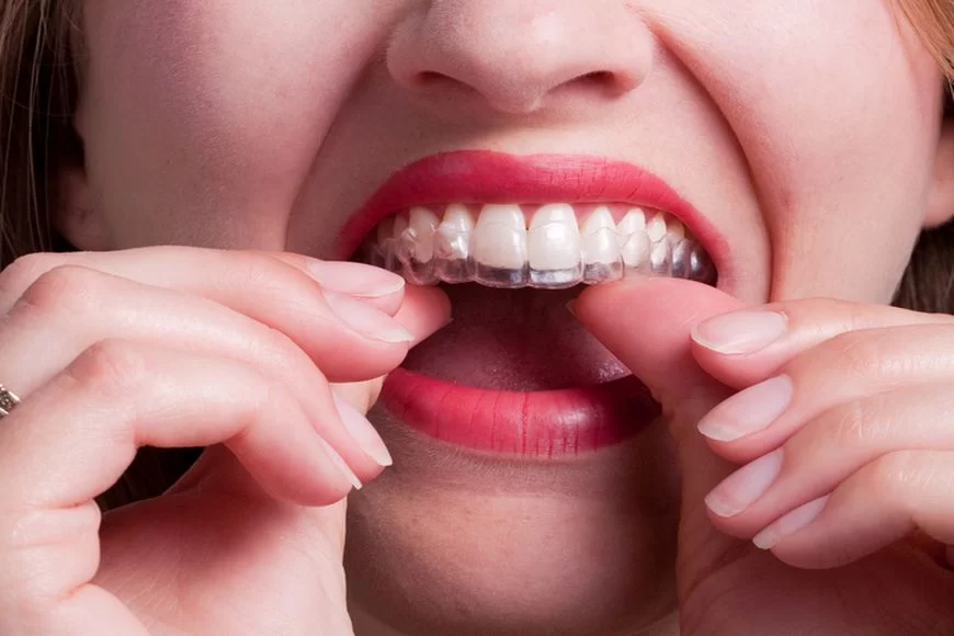 Diamond Dental Group Of Diamond Bar Picture 5