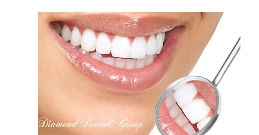 Diamond Dental Group Of Diamond Bar Picture 7