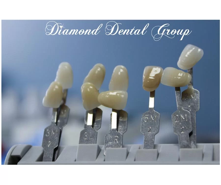 Diamond Dental Group Of Diamond Bar Picture 10
