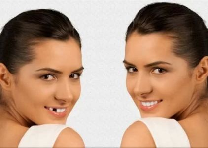Joseph Sarkissian DDS