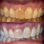 Virginia Van Osdel, DDS