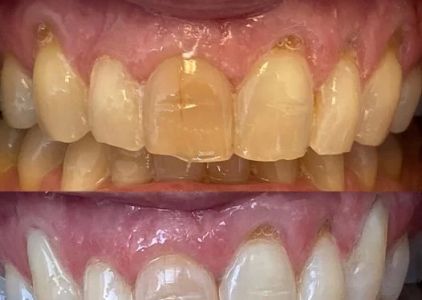 Virginia Van Osdel, DDS