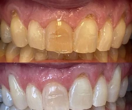 Virginia Van Osdel, DDS