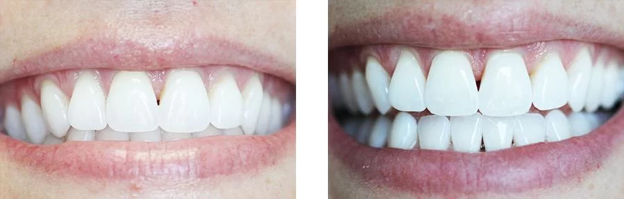 Virginia Van Osdel, DDS 4