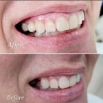Oliver Cruz, DDS