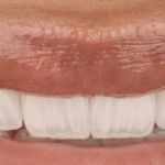 Central Florida Cosmetic & Family Dentistry