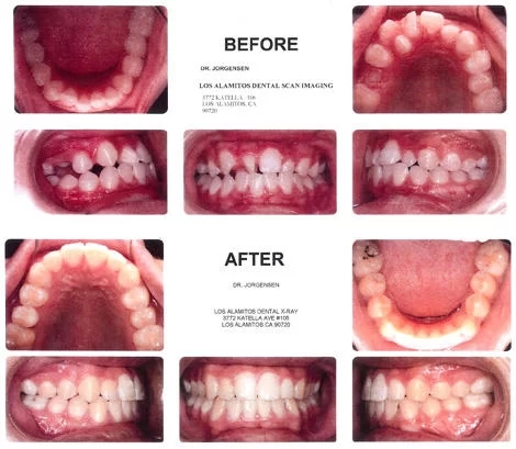 Jorgensen Orthodontics 1