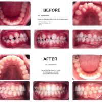 Jorgensen Orthodontics ico