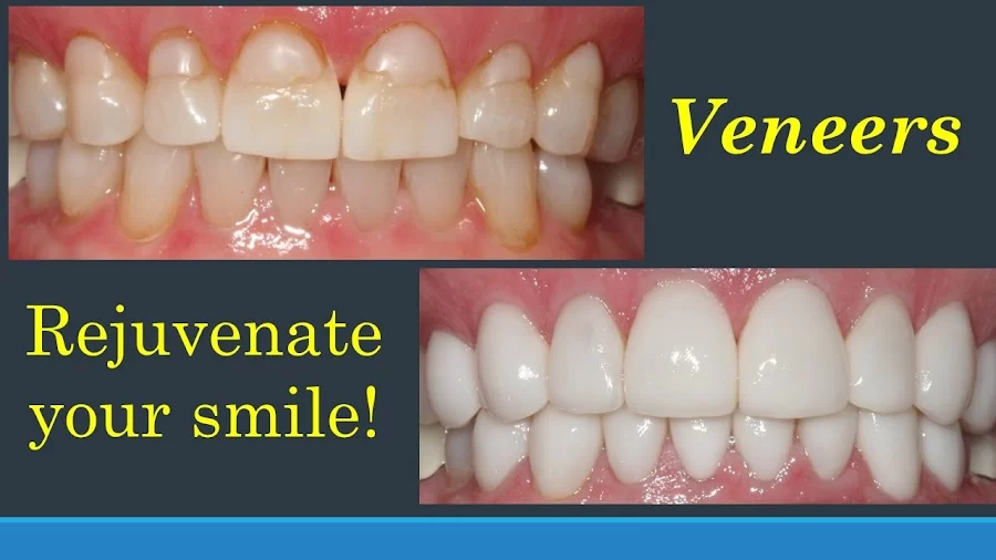 Smiles in Buckhead/Kendra Derrick, DDS 3