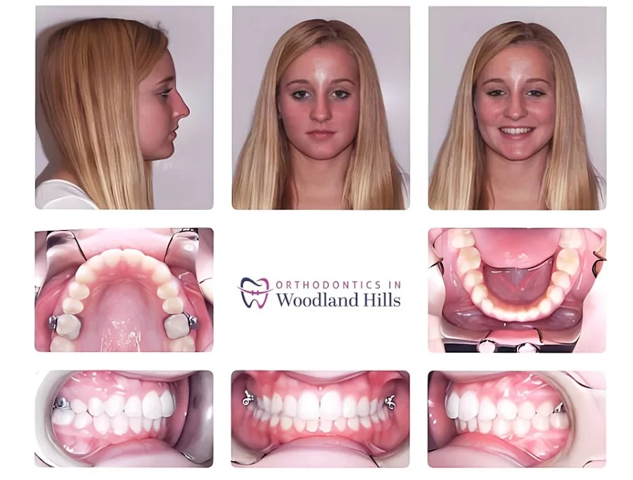 Orthodontics in Woodland Hills 5