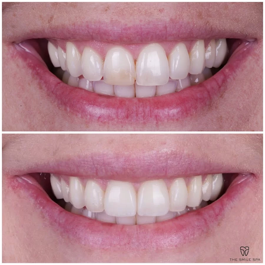 The Smile Spa Picture 5