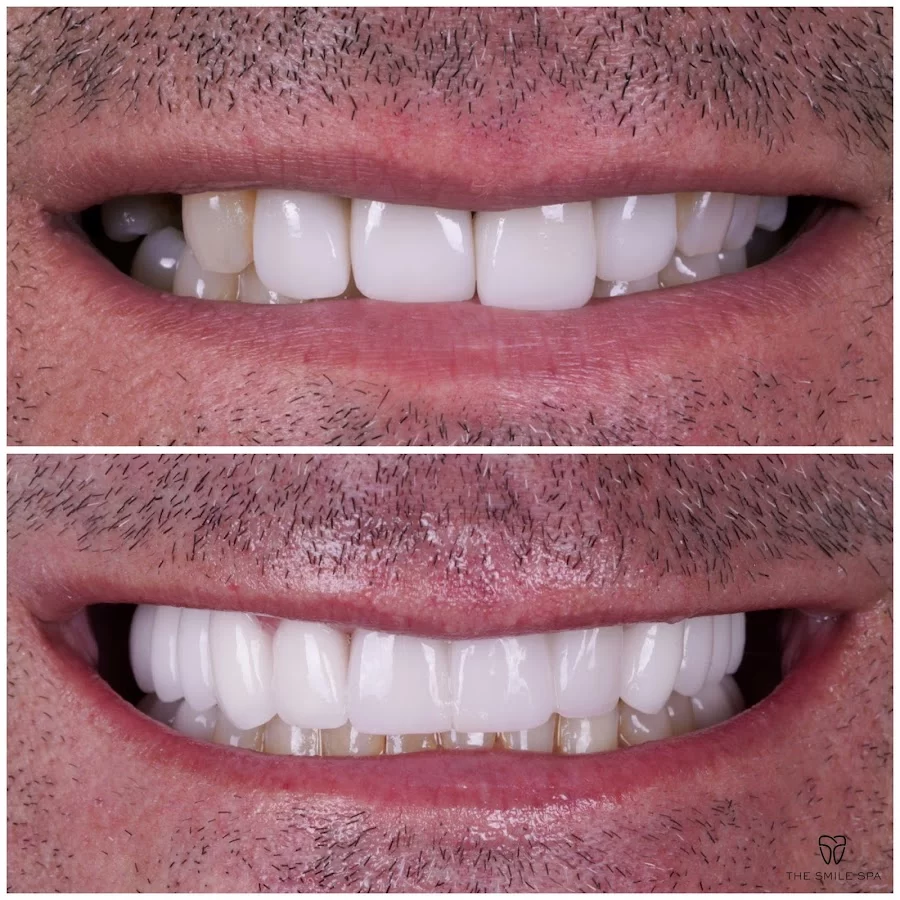 The Smile Spa Picture 8