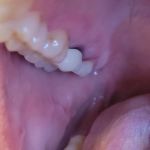 A Belmont Dental Care