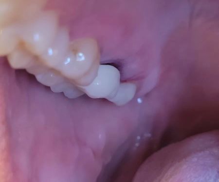 A Belmont Dental Care
