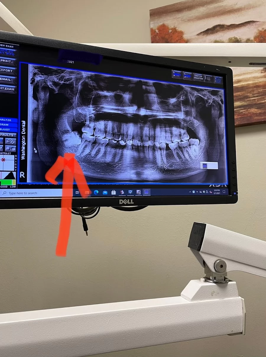 Washington Dental 10