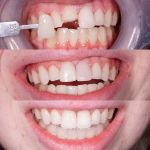 Downtown Dental
