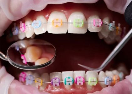Kendrick Orthodontics