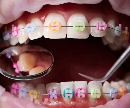 Kendrick Orthodontics