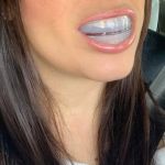 Rockstar White Teeth Whitening