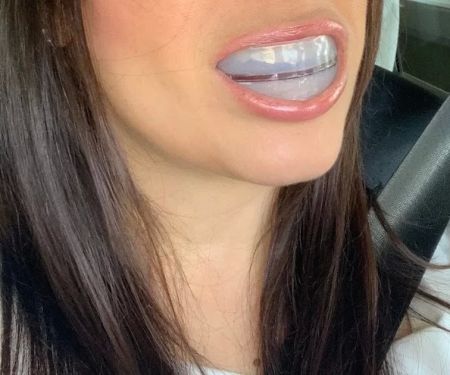 Rockstar White Teeth Whitening