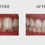 Enhance Dentist