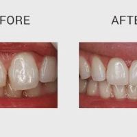 Enhance Dentist ico